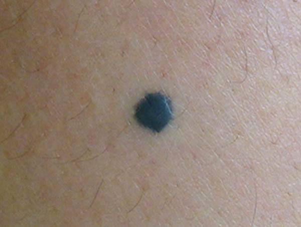 Blue mole